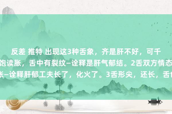 反差 推特 出现这3种舌象，齐是肝不好，可千万别再拖了！1舌双方饱读胀，舌中有裂纹—诠释是肝气郁结。2舌双方情态红，舌边饱读胀—诠释肝郁工夫长了，化火了。3舌形尖，还长，舌色淡白，舌头没少许血色——诠释肝血不及